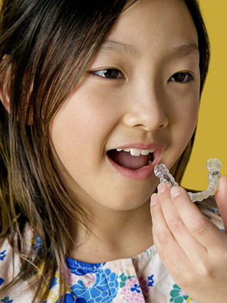 invisalign first for children