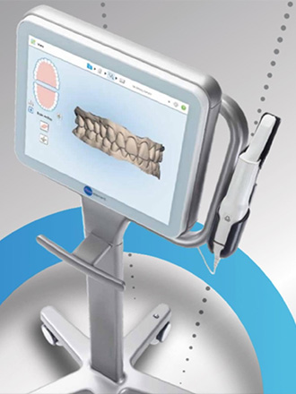 itero digital impression system